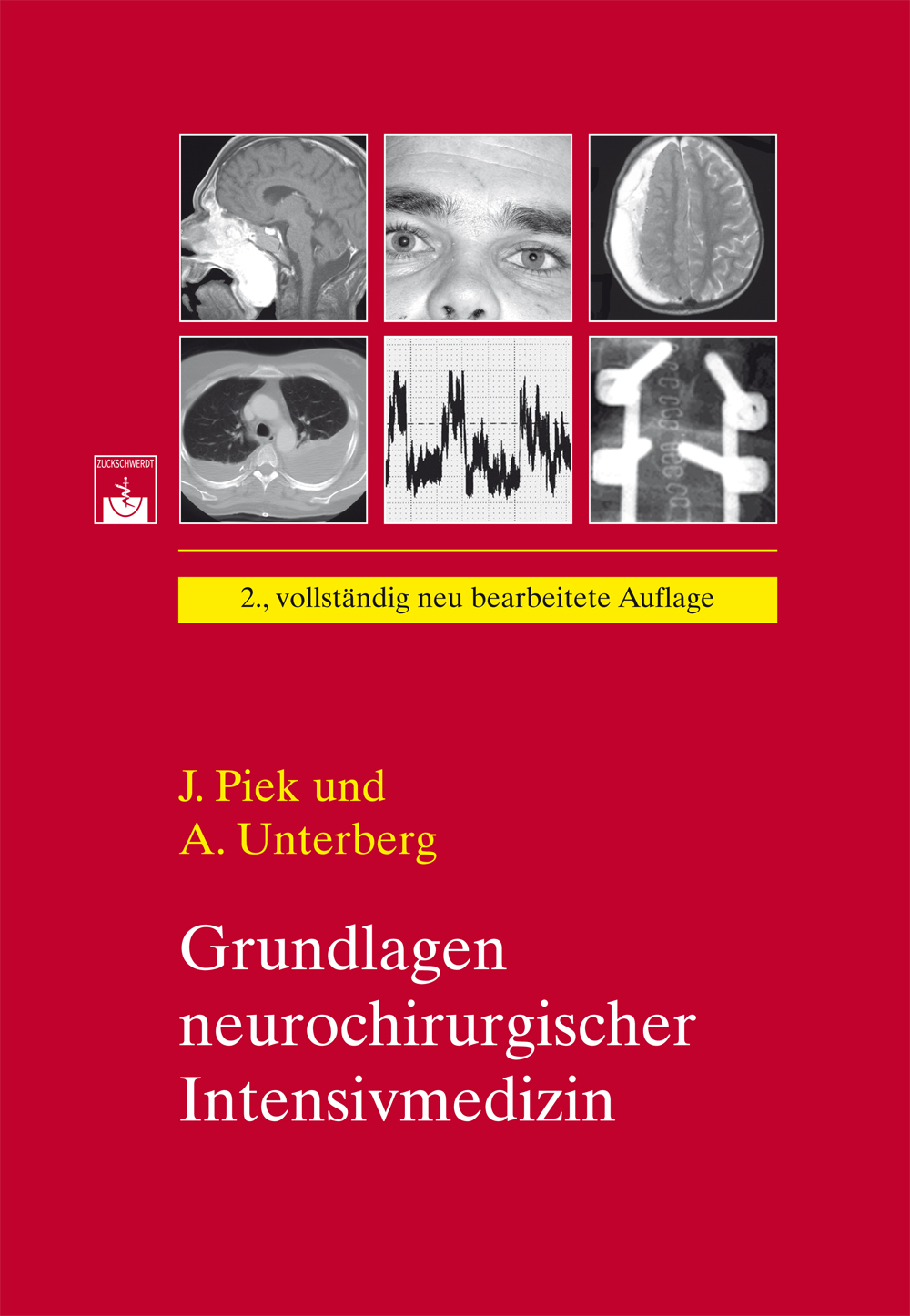 Cover Grundlagen neurochirurgischer Intensivmedizin