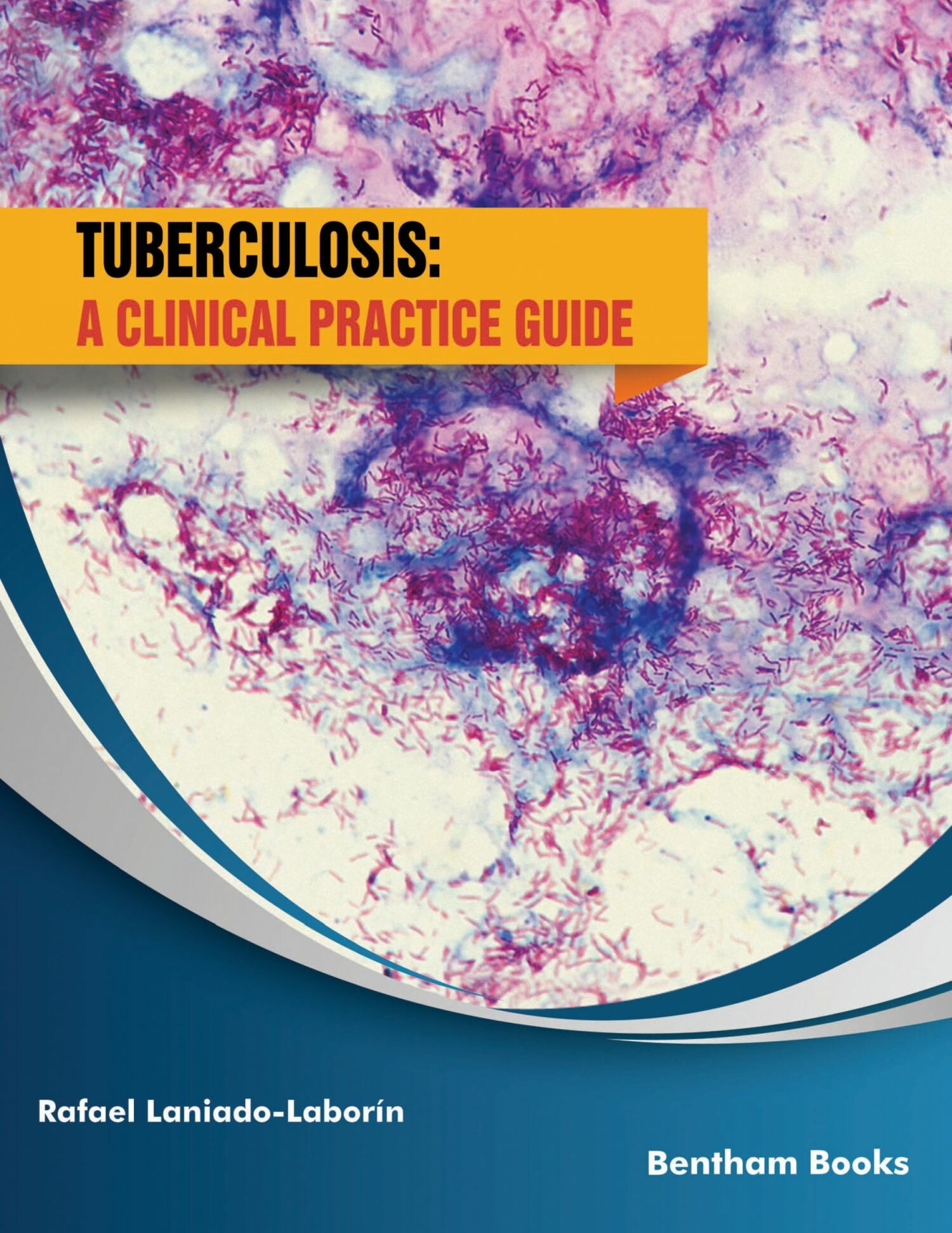 Cover Tuberculosis: A Clinical Practice Guide