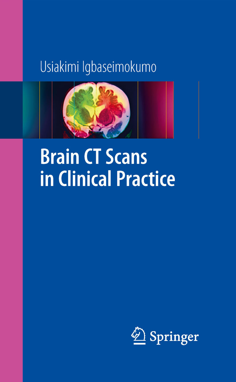 Cover Brain CT Scans in Clinical Practice