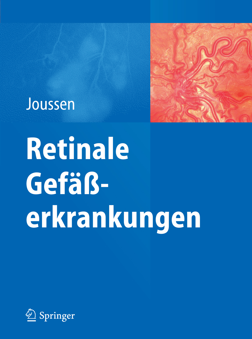 Cover Retinale Gefäßerkrankungen