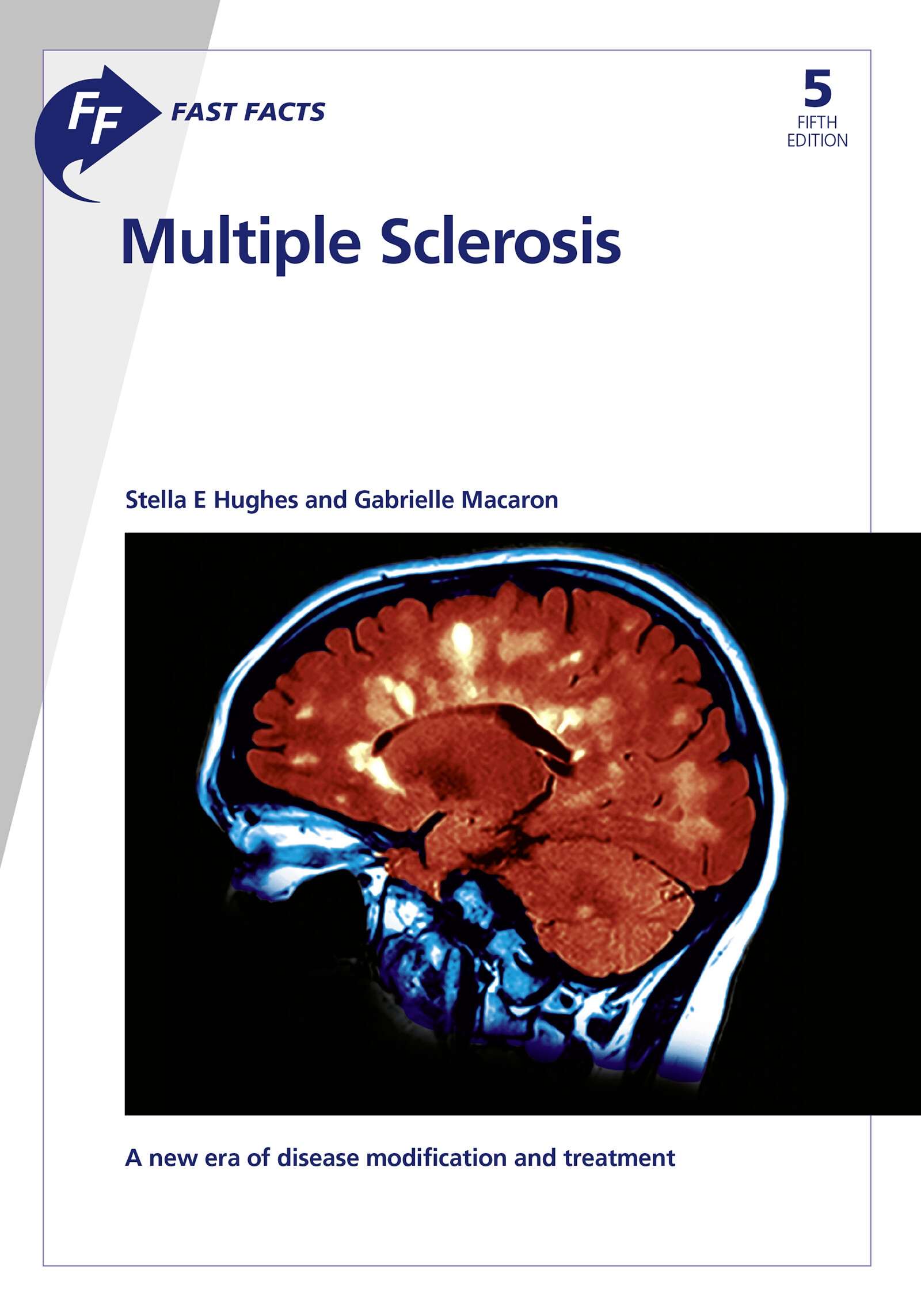 Fast Facts: Multiple Sclerosis