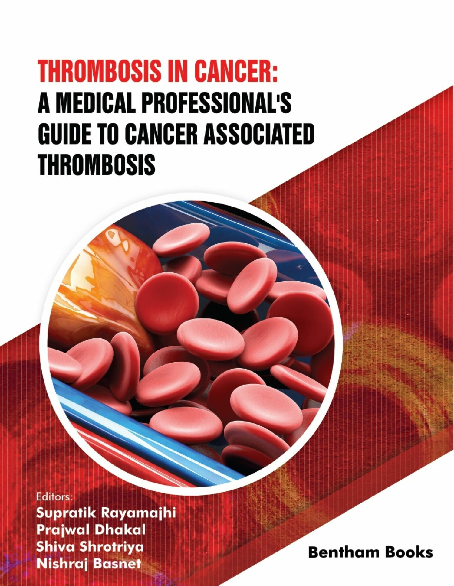 Cover Thrombosis in Cancer: A Medical Professional's Guide to Cancer Associated Thrombosis