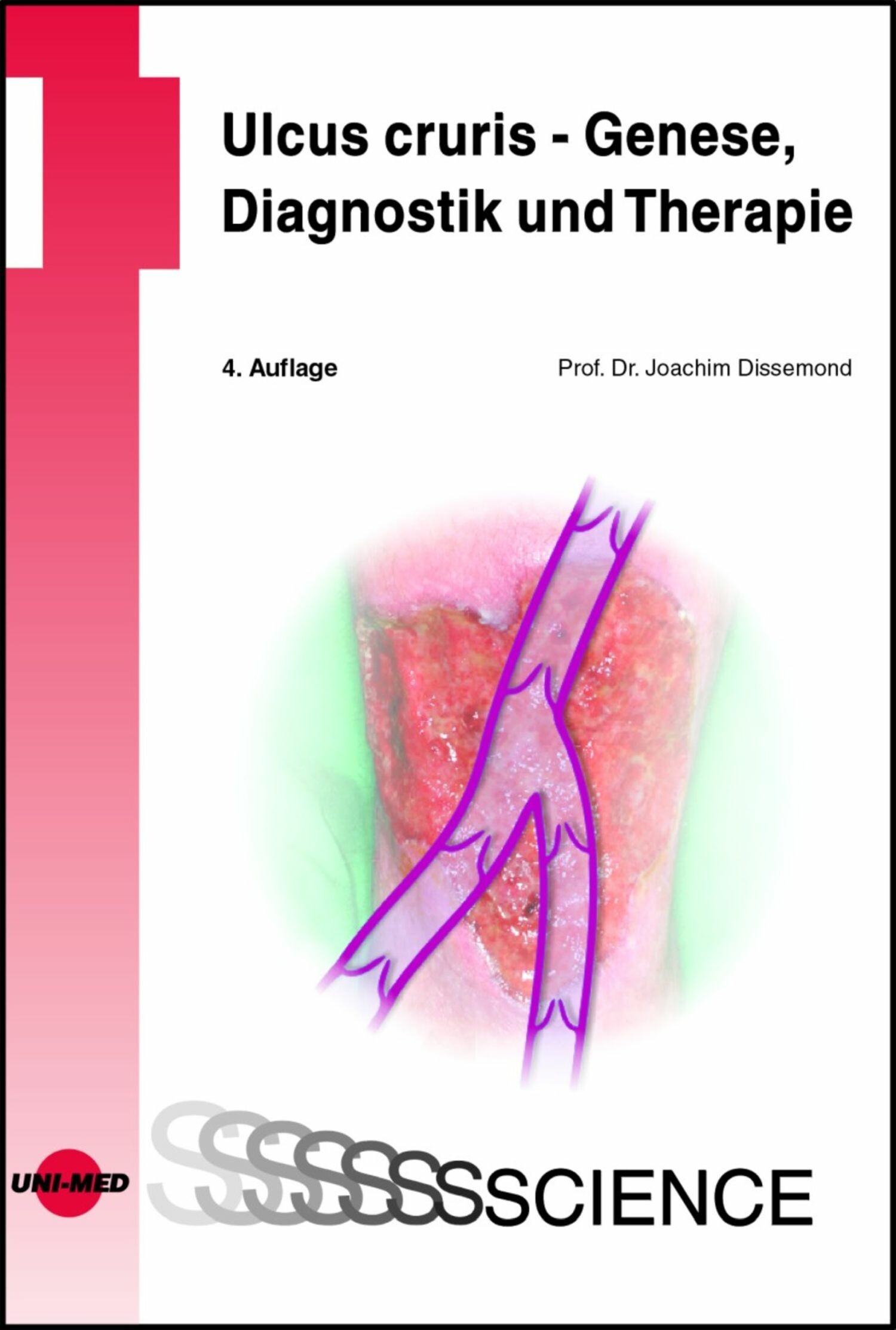 Ulcus Cruris Genese Diagnostik Und Therapie E Book
