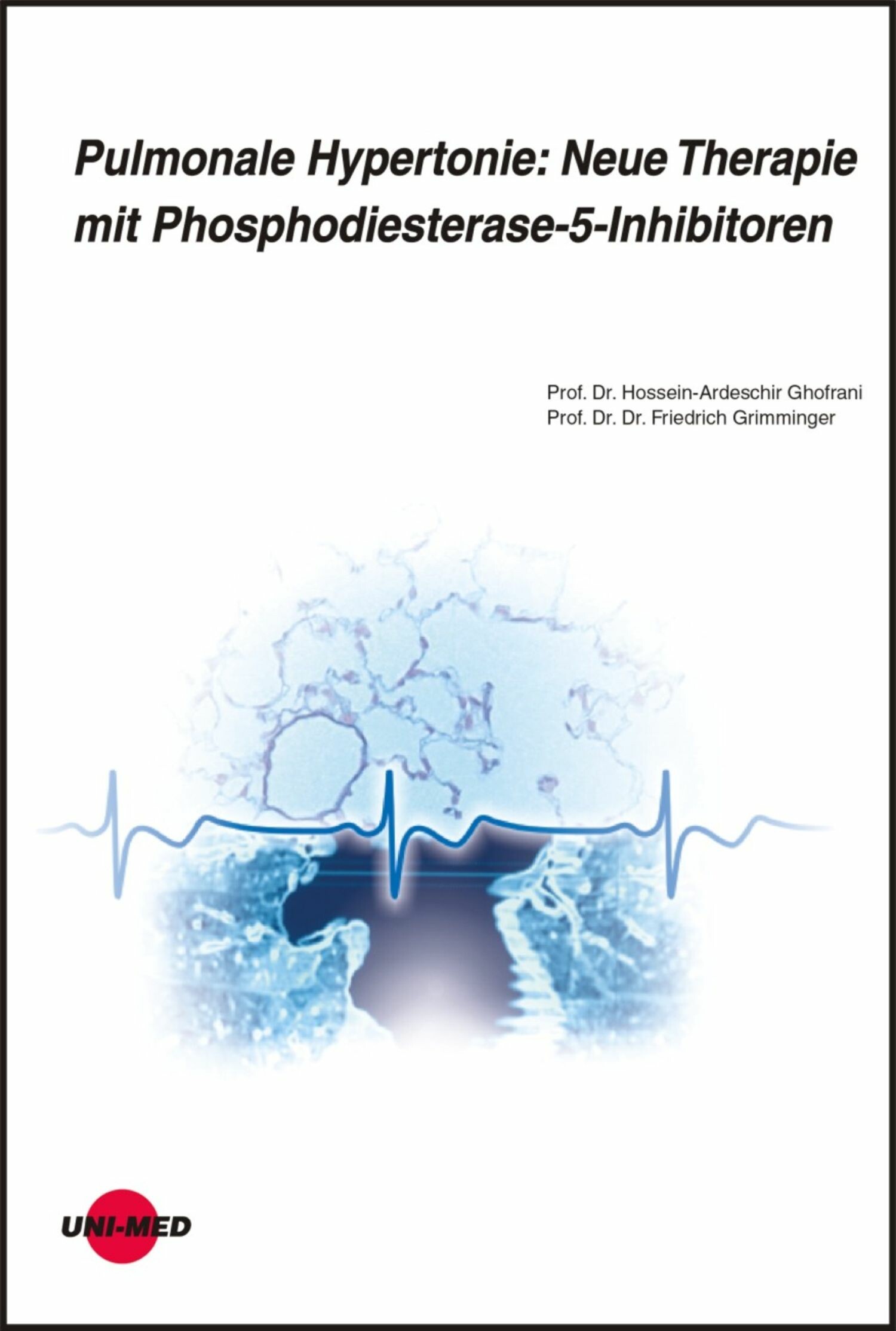 Pulmonale Hypertonie: Neue Therapie mit Phosphodiesterase-5-Inhibitoren