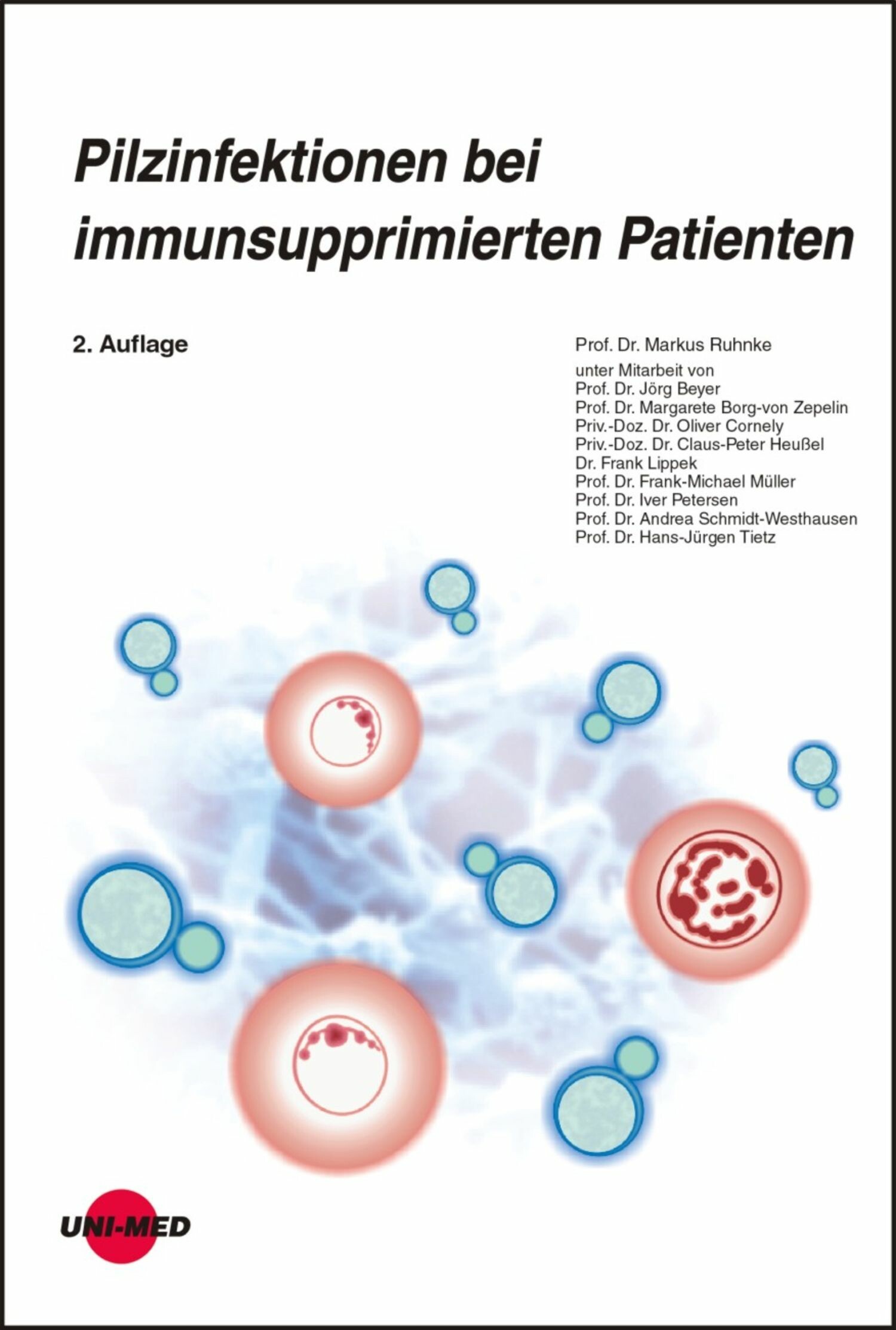 Pilzinfektionen bei immunsupprimierten Patienten
