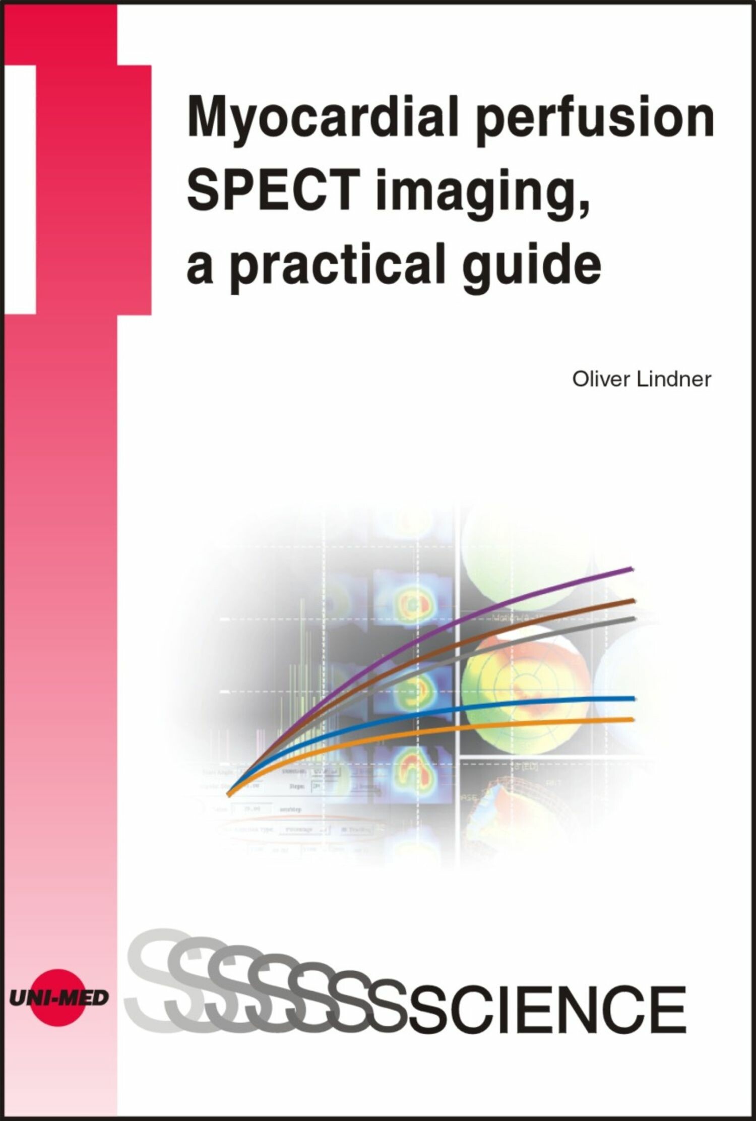 Cover Myocardial perfusion SPECT imaging, a practical guide