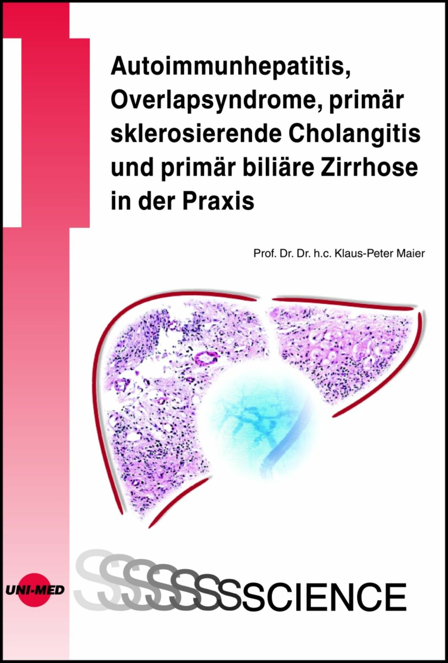 Cover Autoimmunhepatitis, Overlapsyndrome, primär sklerosierende Cholangitis und primär biliäre Zirrhose in der Praxis