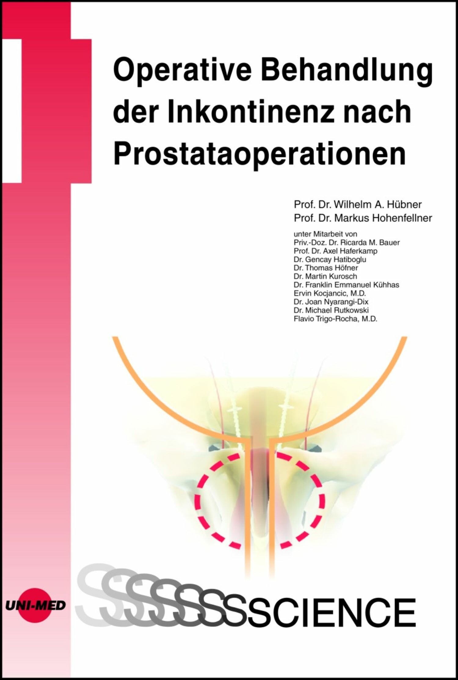 Cover Operative Behandlung der Inkontinenz nach Prostataoperationen