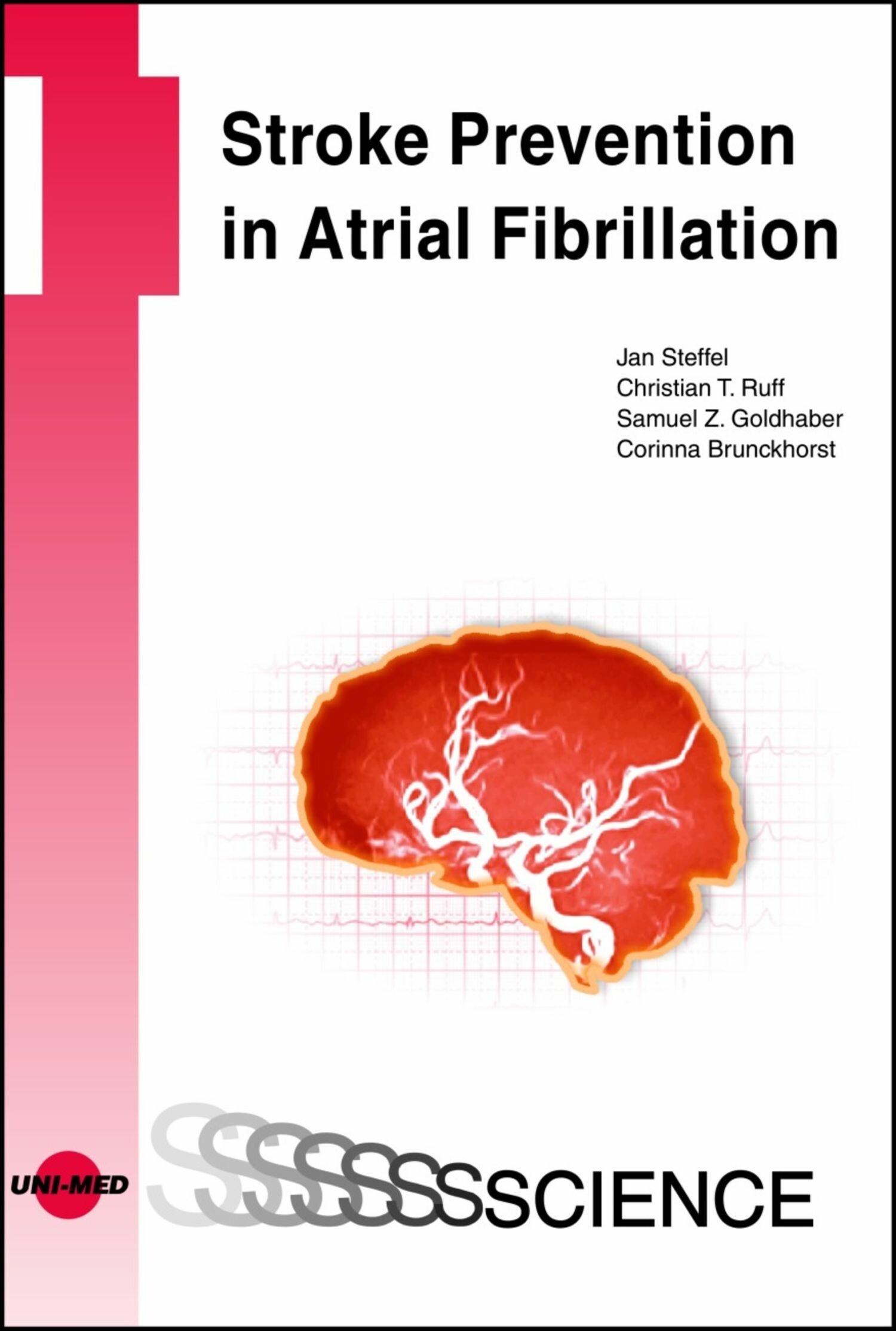 Stroke Prevention In Atrial Fibrillation E Book