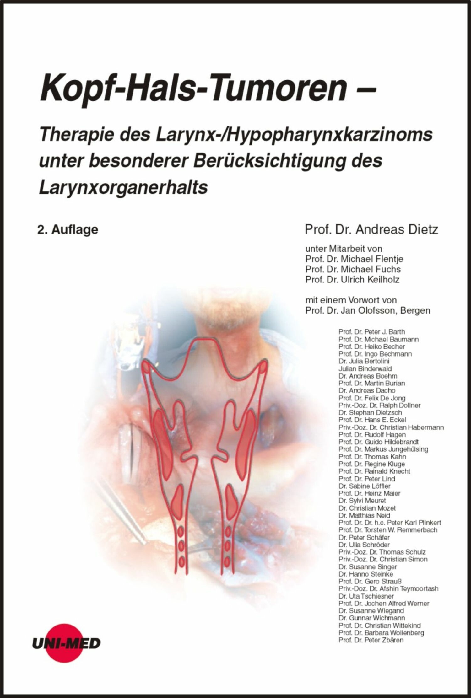 Cover Kopf-Hals-Tumoren - Therapie des Larynx-/Hypopharynxkarzinoms unter besonderer Berücksichtigung des Larynxorganerhalts