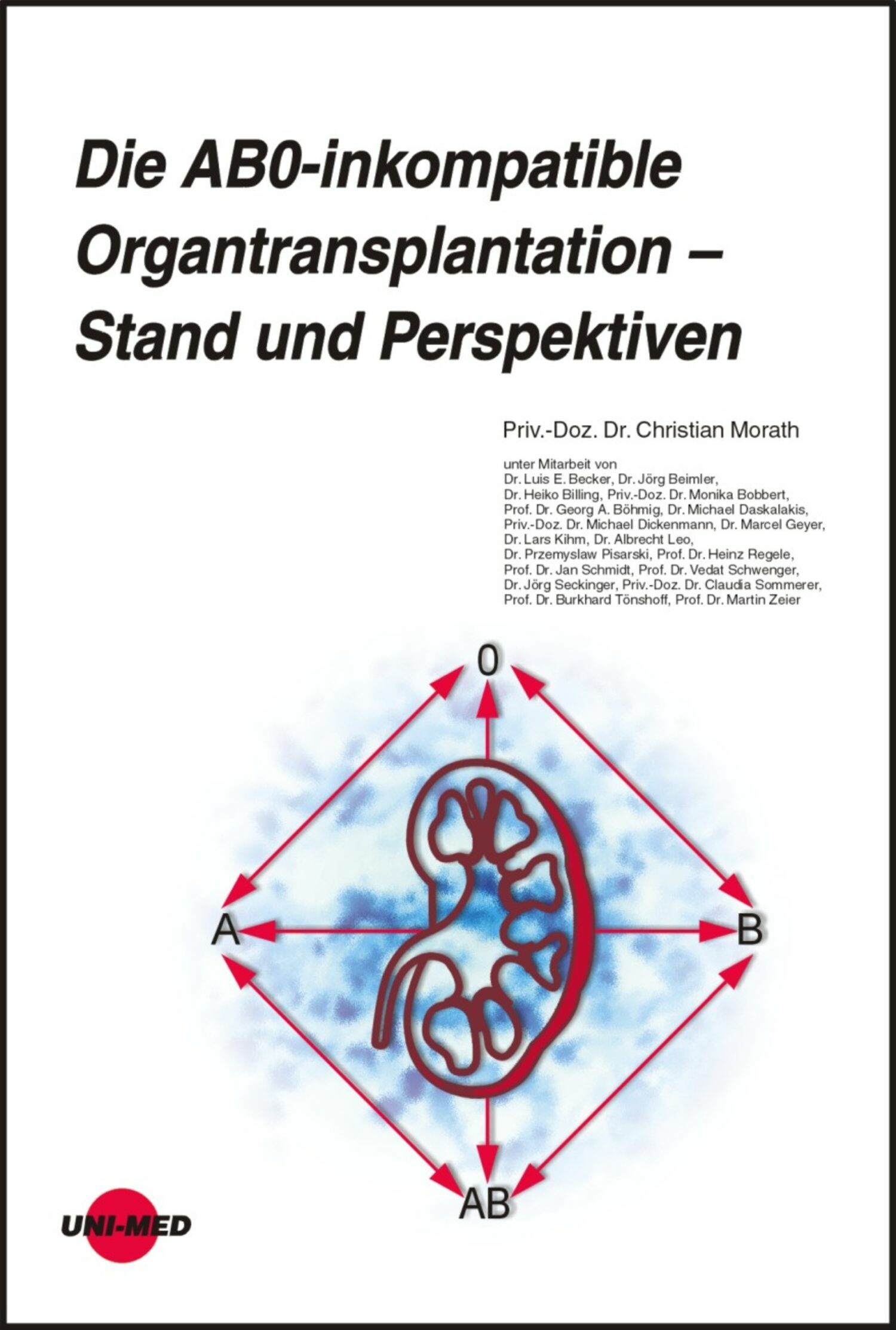 Die AB0-inkompatible Organtransplantation - Stand und Perspektiven