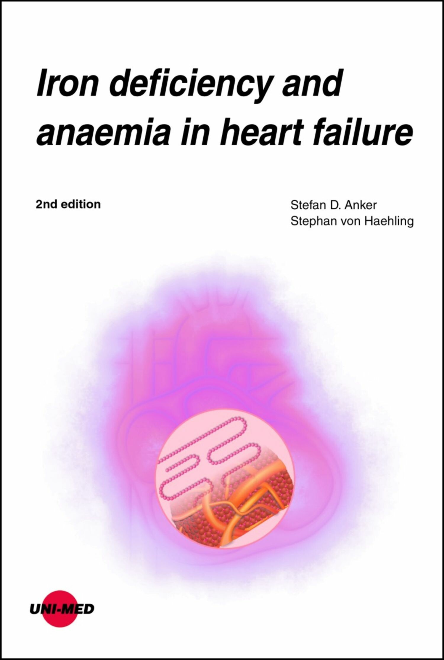 Iron deficiency and anaemia in heart failure