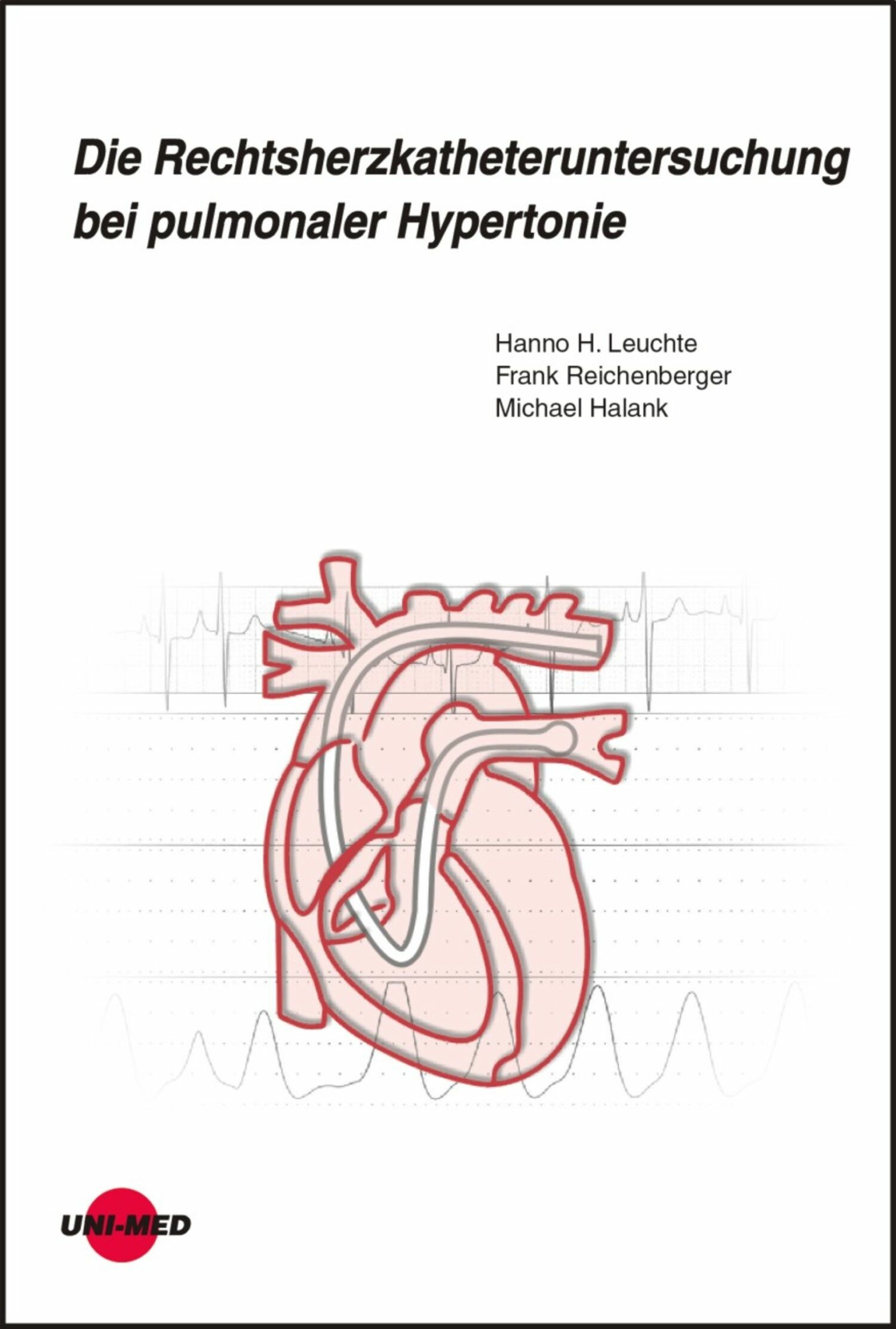 Cover Die Rechtsherzkatheteruntersuchung bei pulmonaler Hypertonie