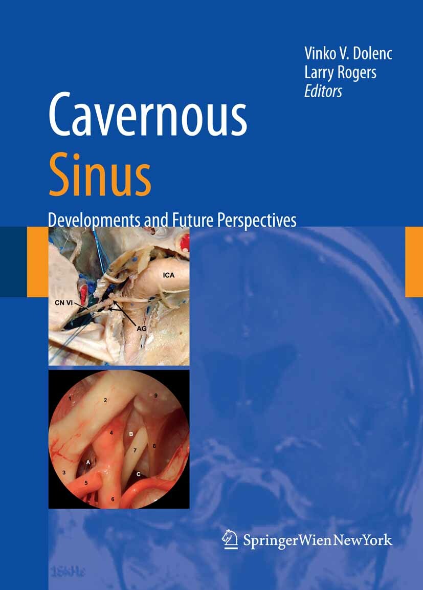 Cover Cavernous Sinus