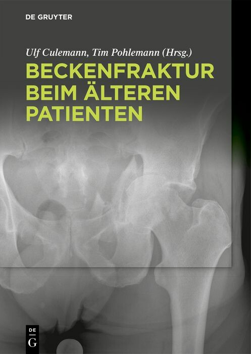 Cover Beckenfraktur beim älteren Patienten