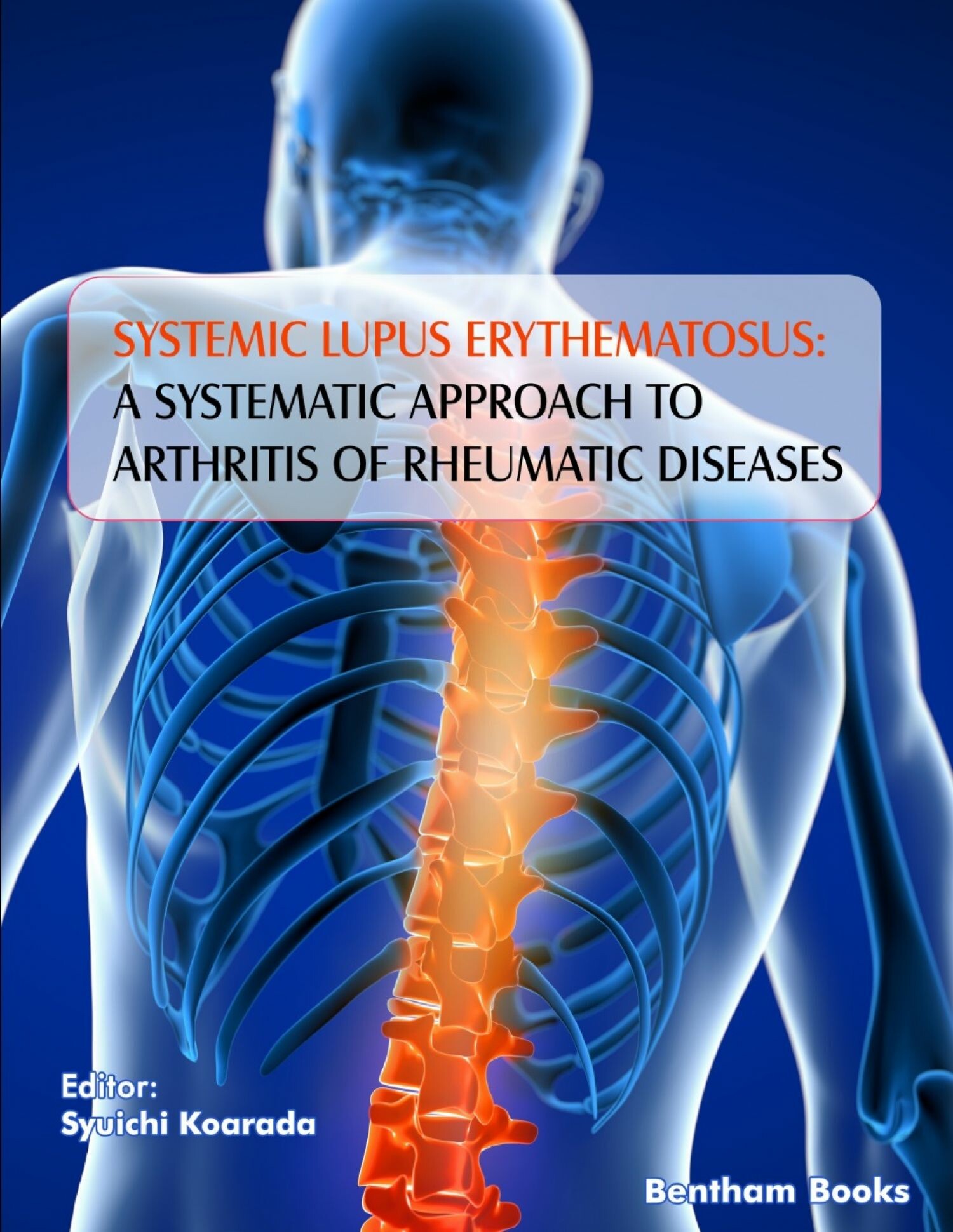 Cover Systemic Lupus Erythematosus: A Systematic Approach to Arthritis of Rheumatic Diseases: Volume 4