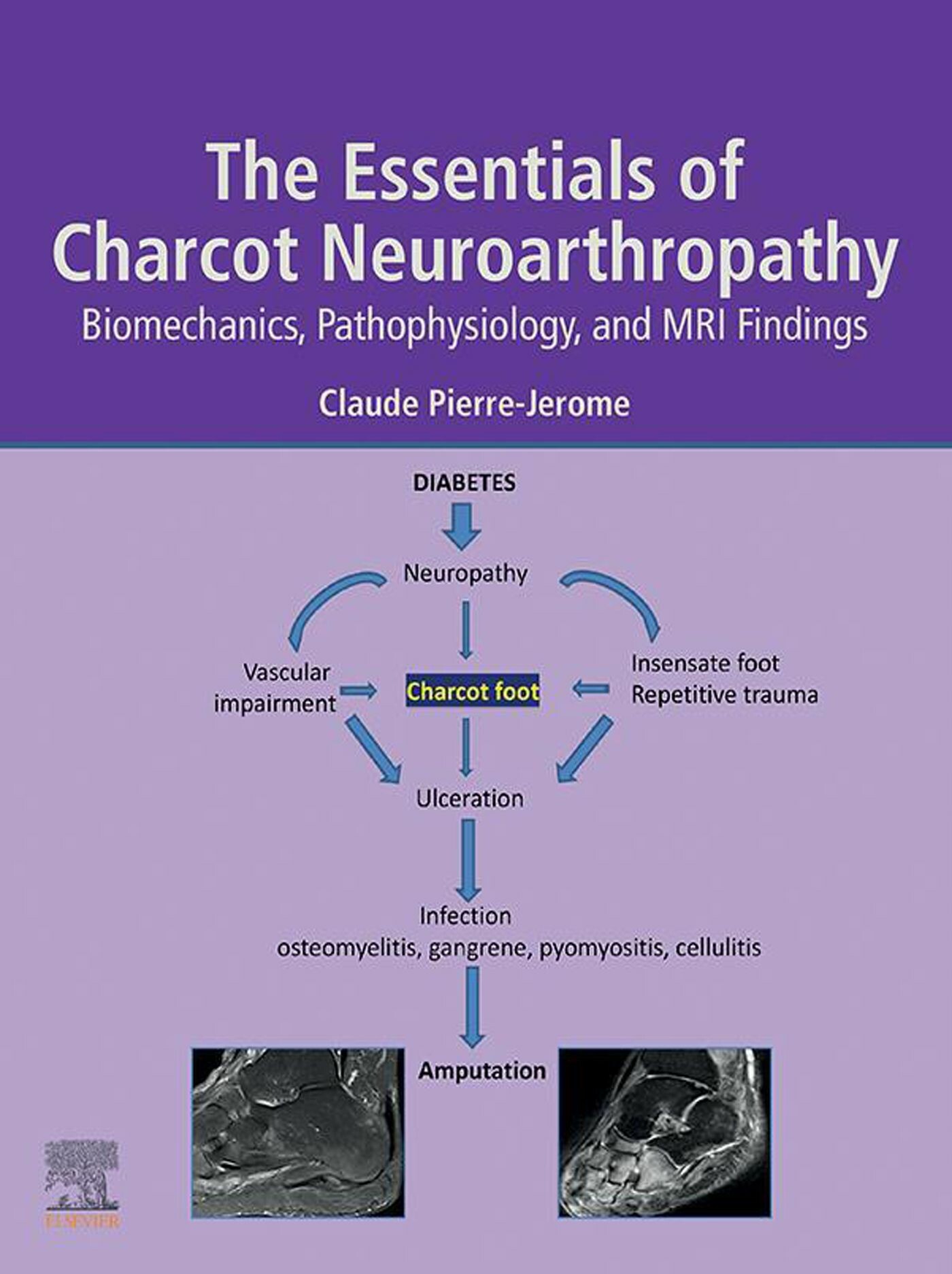 Cover The Essentials of Charcot Neuroarthropathy