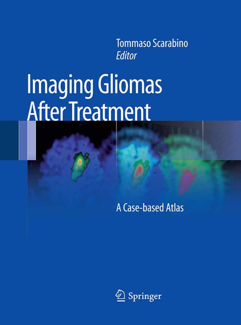 Cover Imaging Gliomas After Treatment