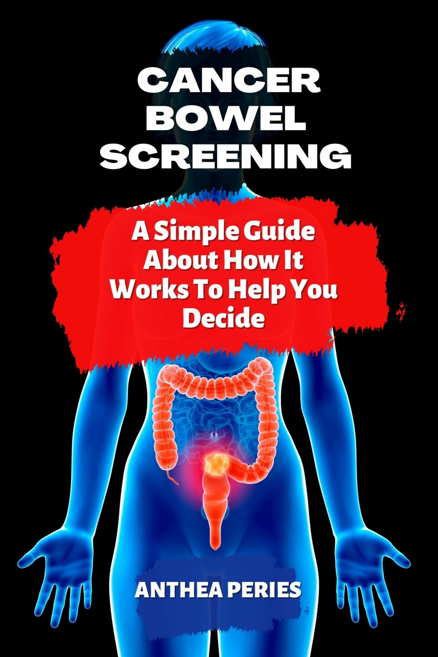 Cancer Bowel Screening