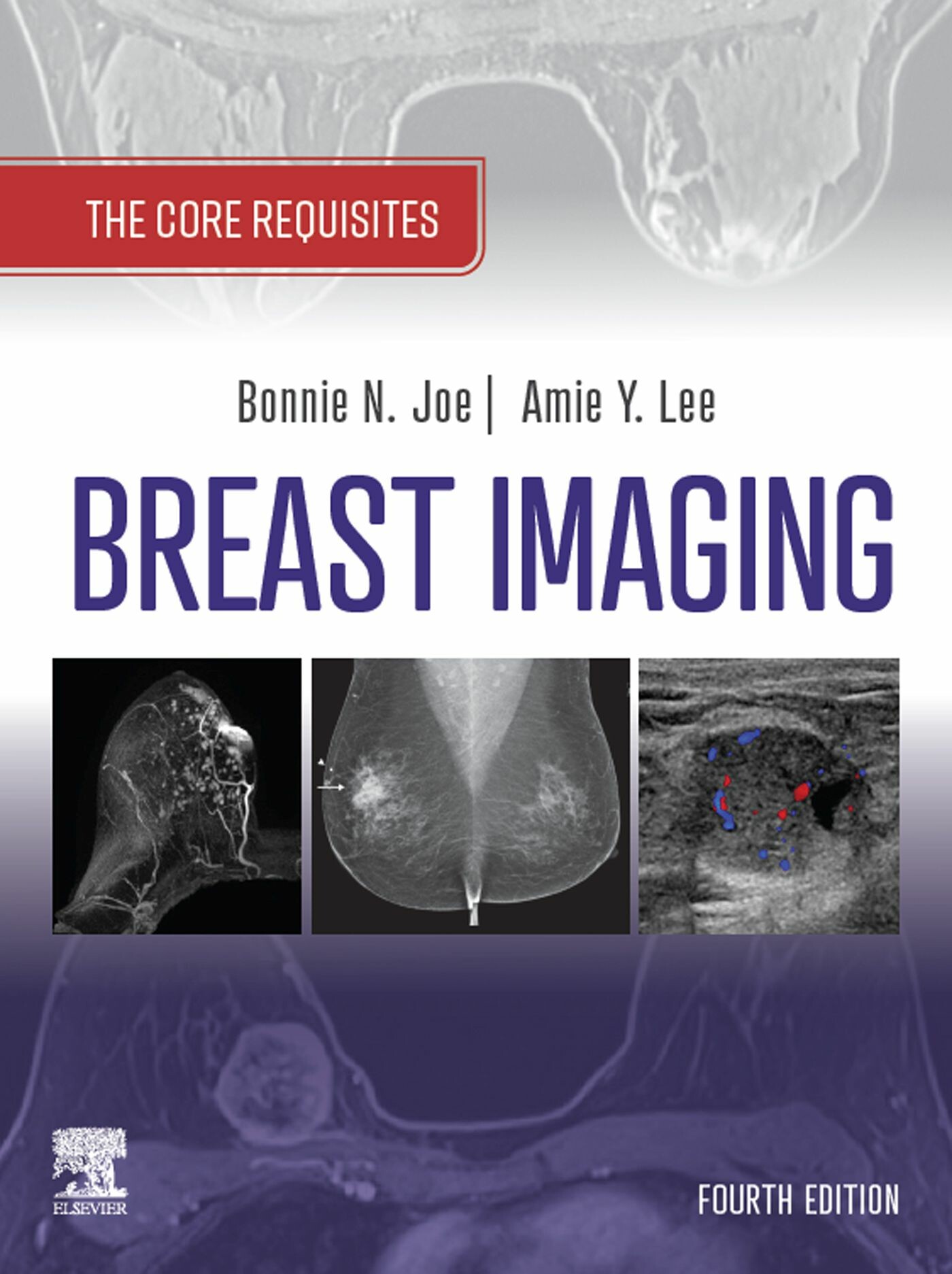 Cover Breast Imaging, E-Book