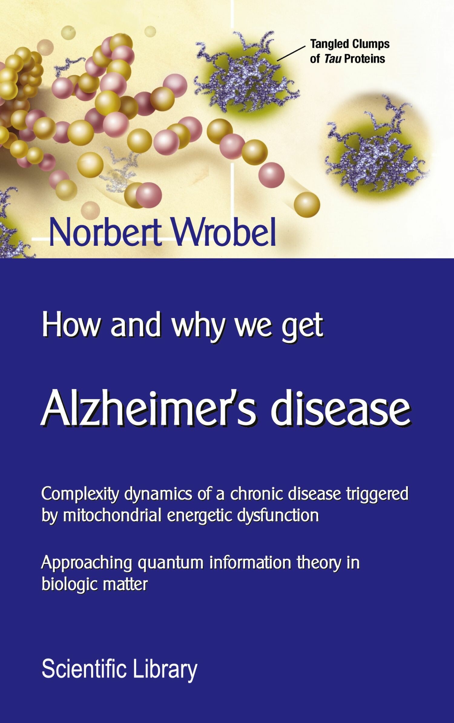 Cover How and why we get Alzheimer's disease