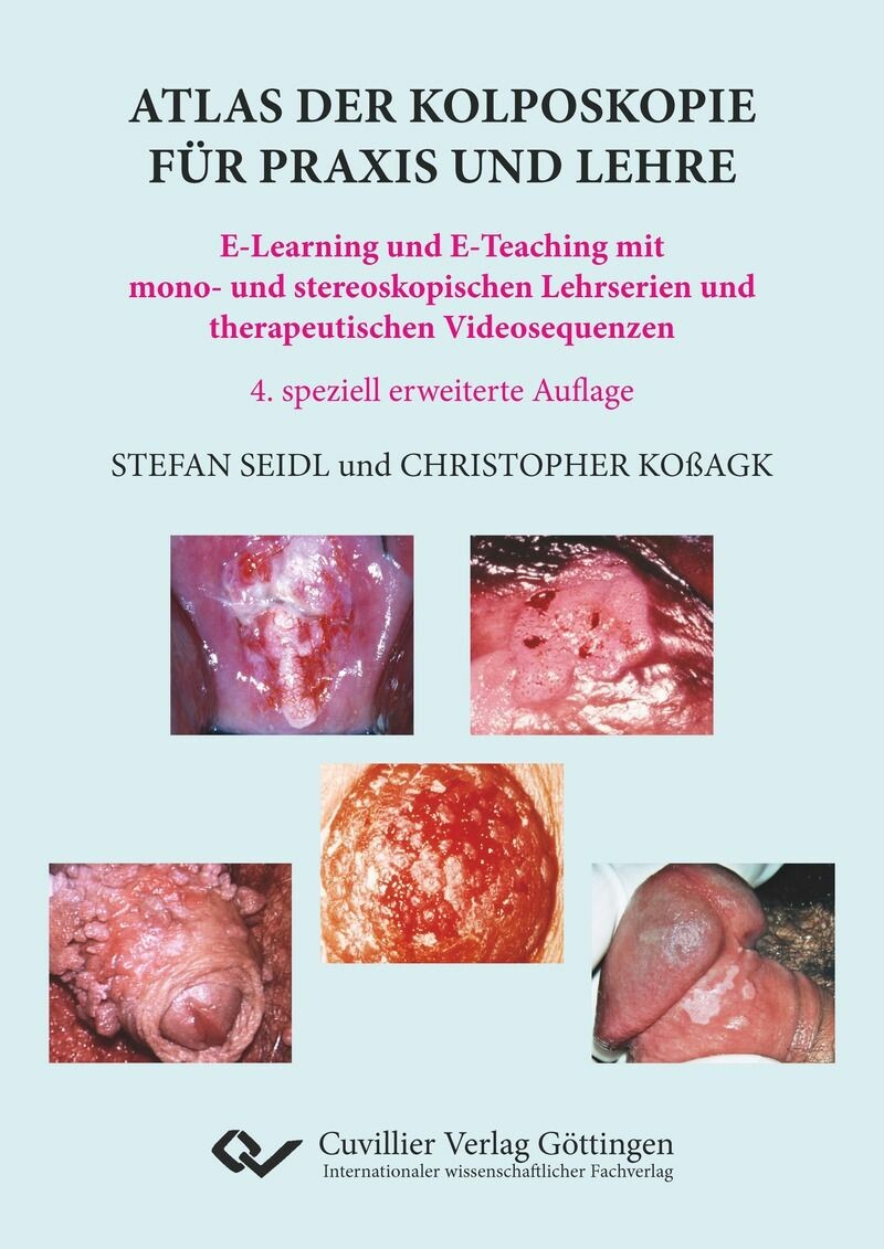 Cover Atlas der Kolposkopie für Praxis und Lehre