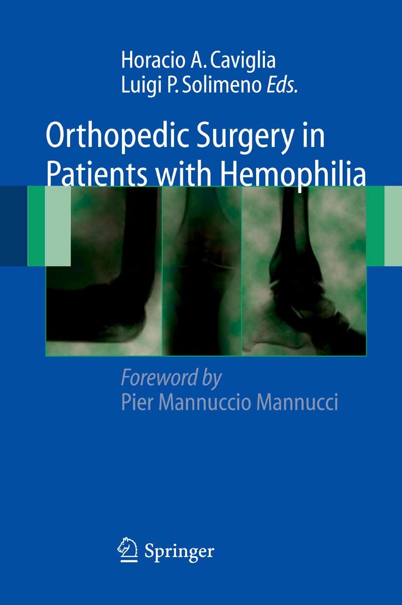 Cover Orthopedic Surgery in Patients with Hemophilia