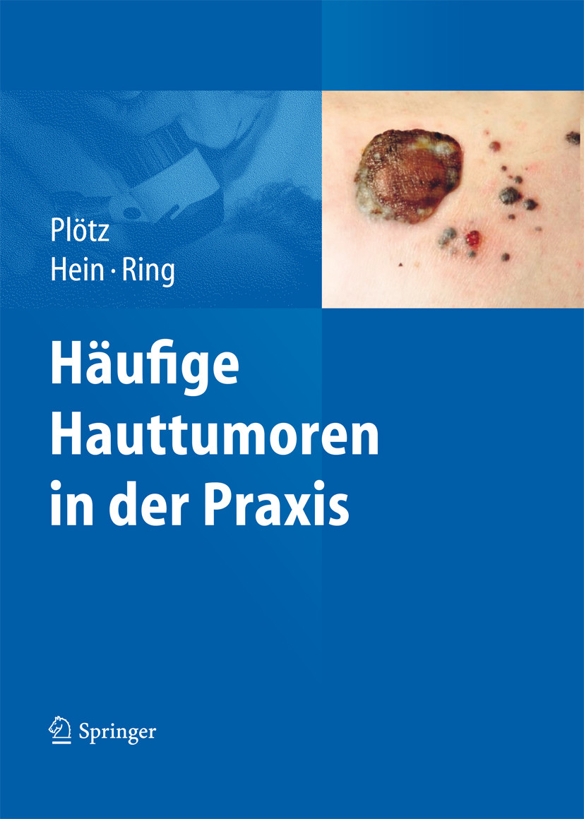 Cover Häufige Hauttumoren in der Praxis