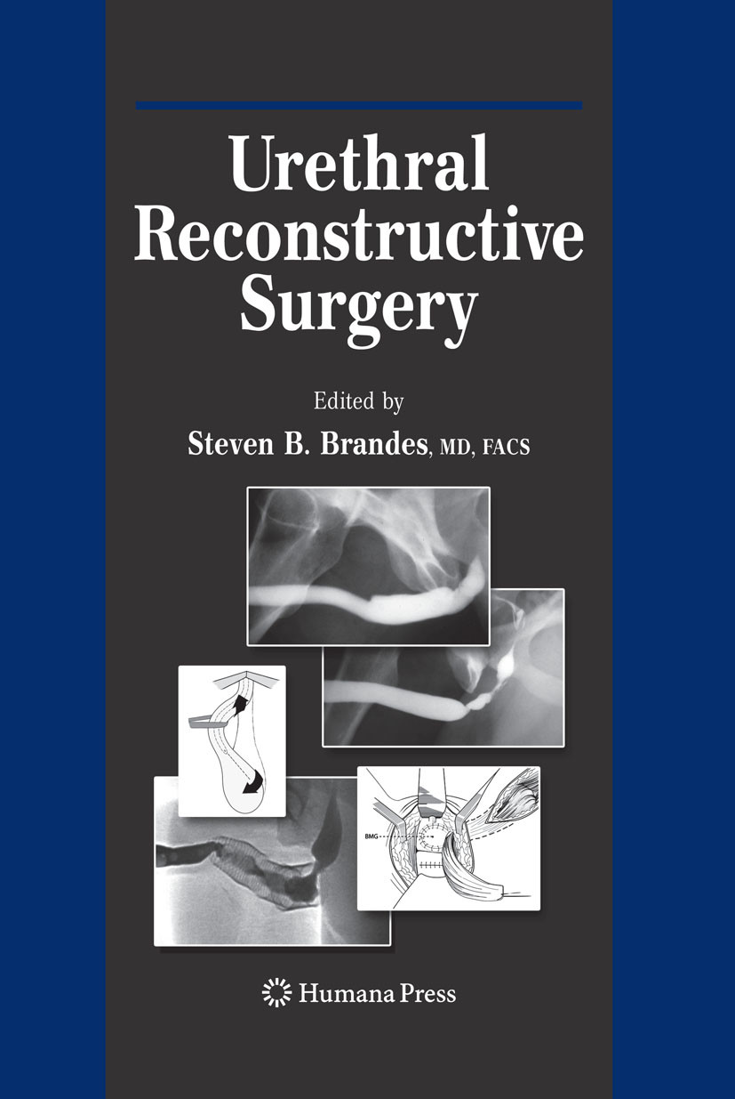 Urethral Reconstructive Surgery