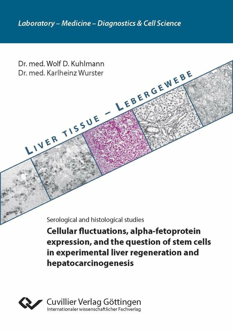 Cover Cellular fluctuations, alpha-fetoprotein expression, and the question of stem cells  in experimental liver regeneration and hepatocarcinogenesis