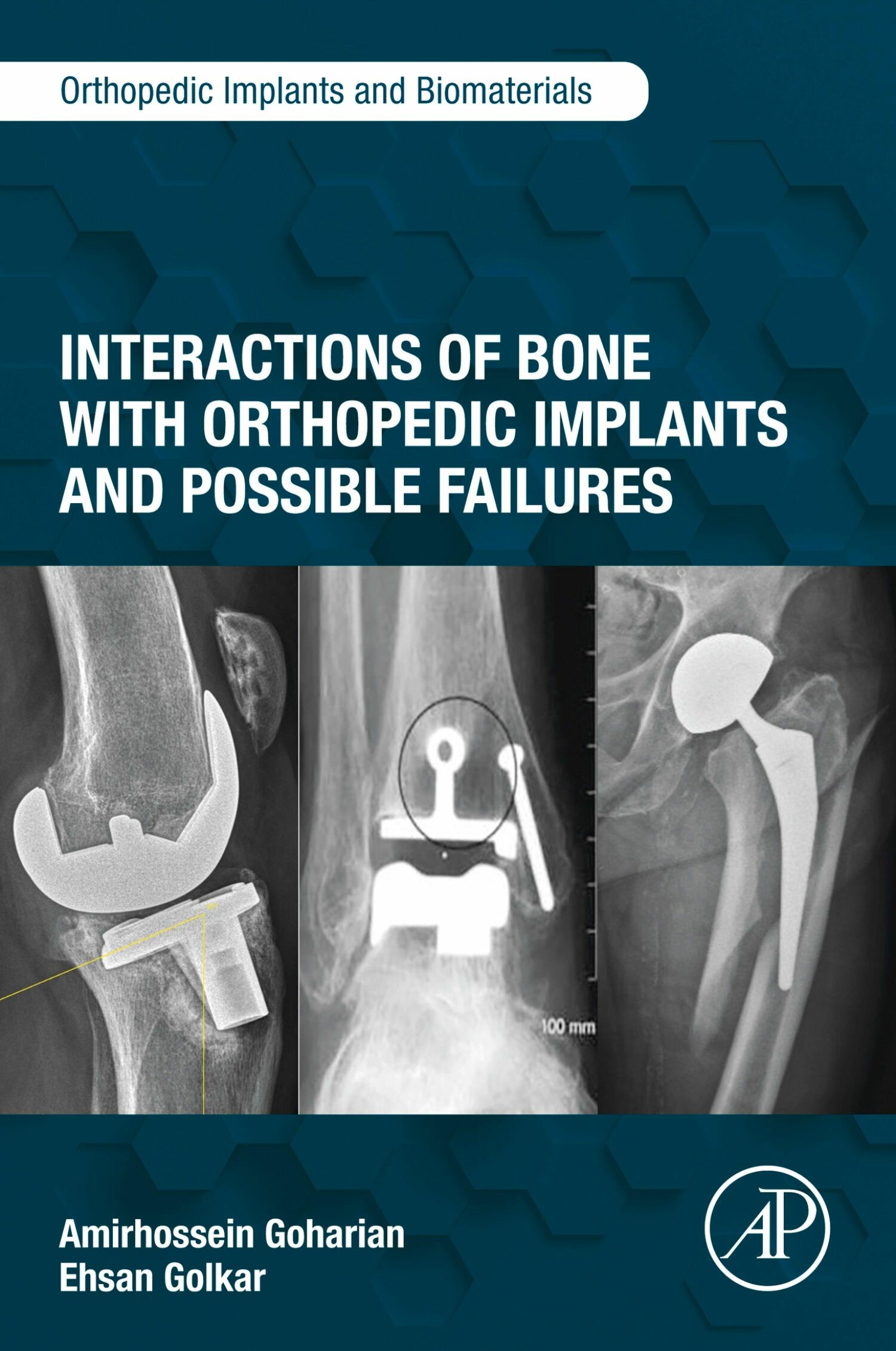 Cover Interactions of Bone with Orthopedic Implants and Possible Failures