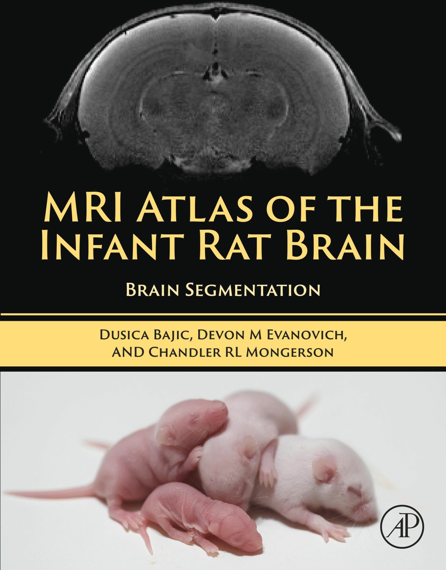 MRI Atlas of the Infant Rat Brain