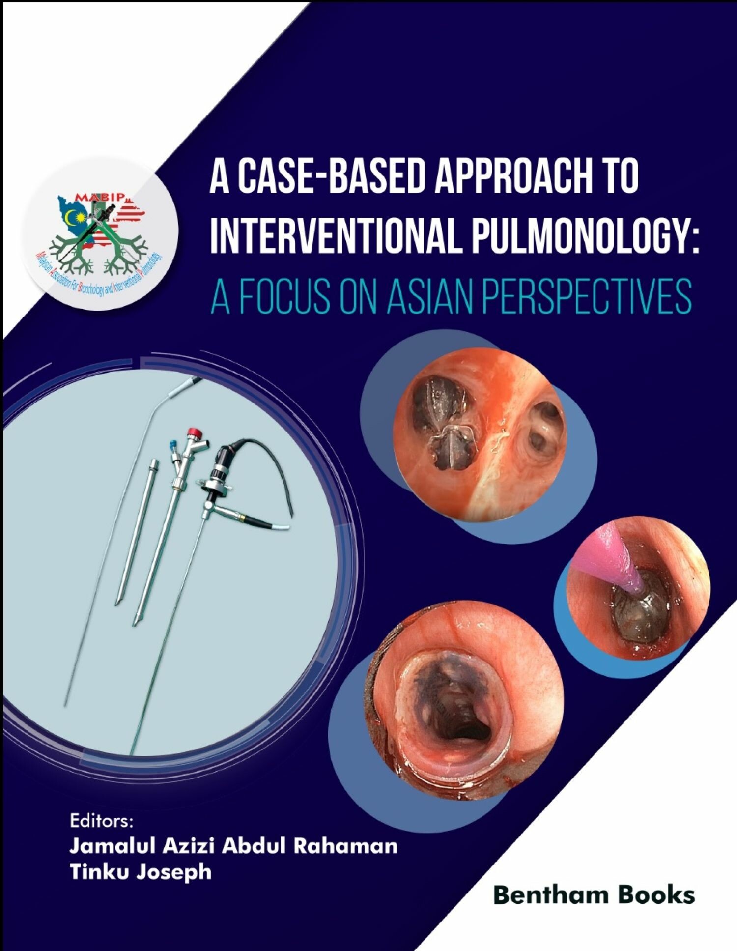 Cover A Case-Based Approach to Interventional Pulmonology: A Focus on Asian Perspectives
