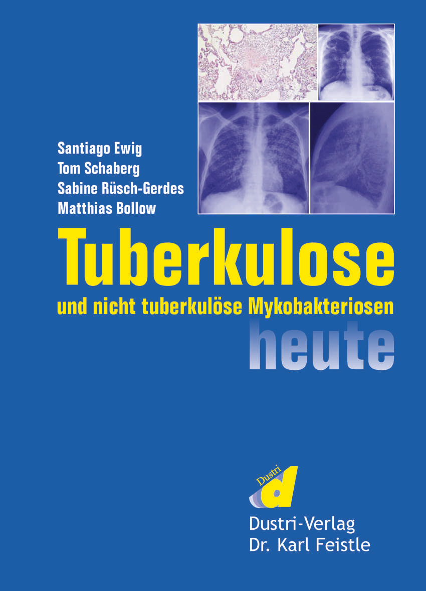 Cover Tuberkulose und nicht tuberkulöse Mykobakteriosen heute