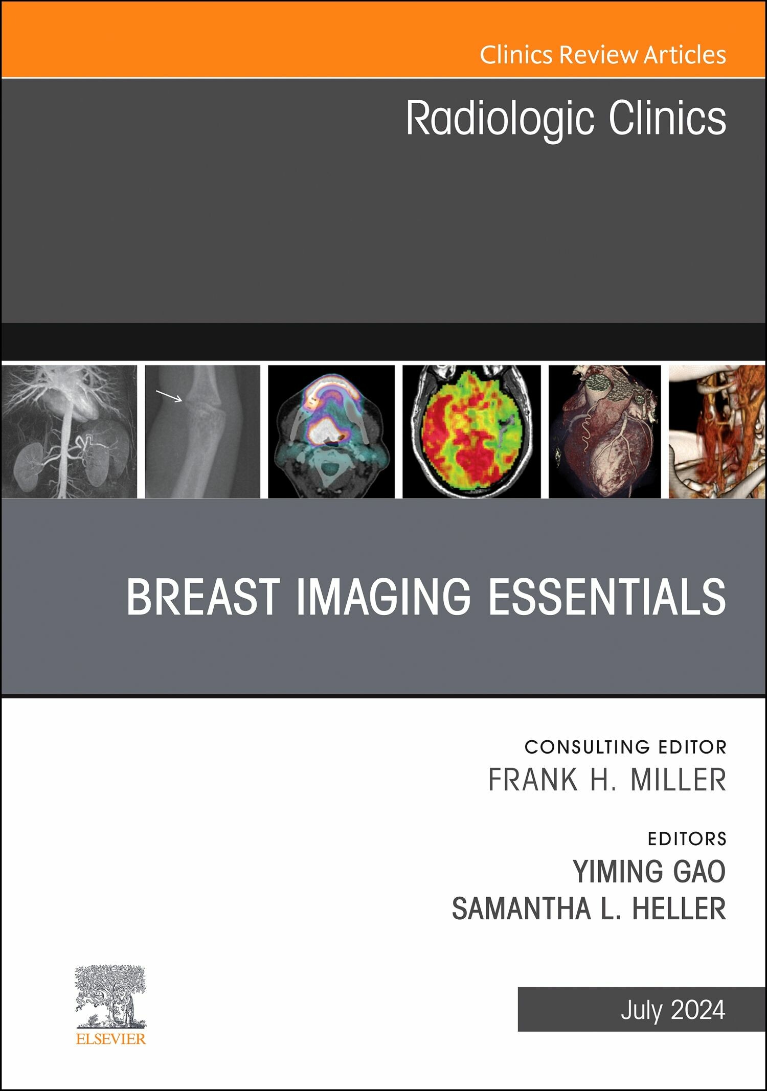 Breast Imaging Essentials, An Issue of Radiologic Clinics of North America, E-Book