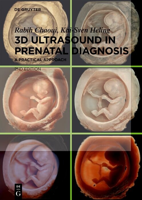 Cover 3D Ultrasound in Prenatal Diagnosis
