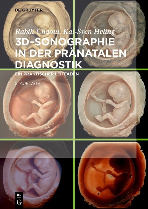 Cover 3D-Sonographie in der pränatalen Diagnostik