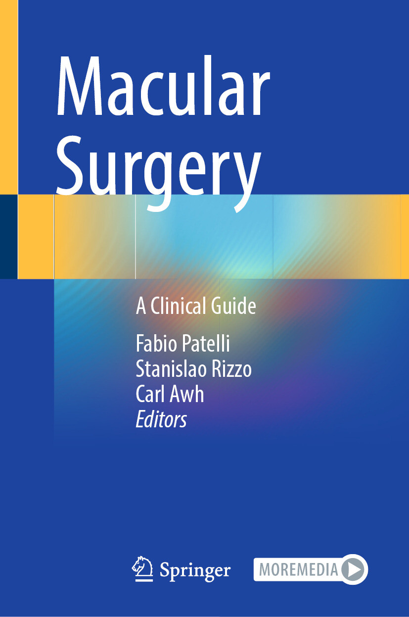 Cover Macular Surgery