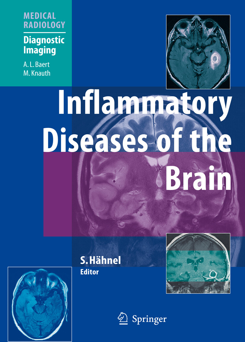 Cover Inflammatory Diseases of the Brain