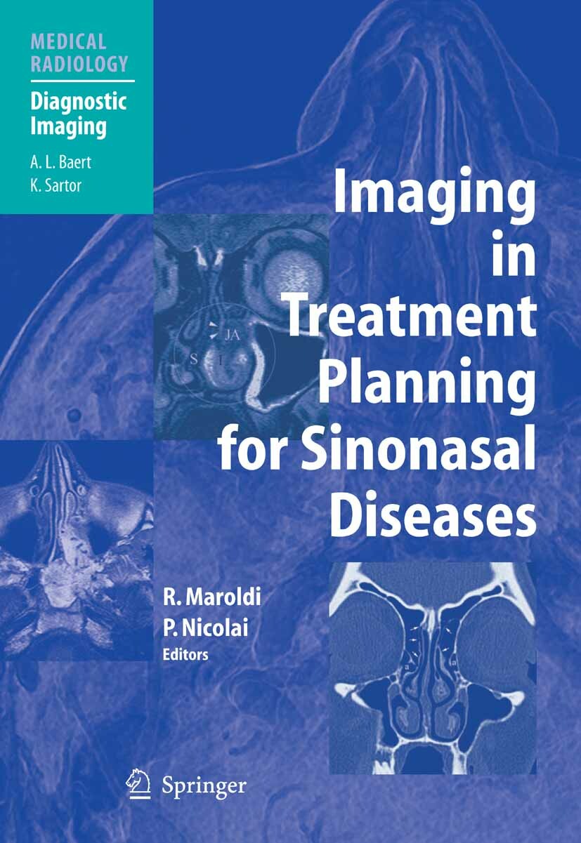 Cover Imaging in Treatment Planning for Sinonasal Diseases