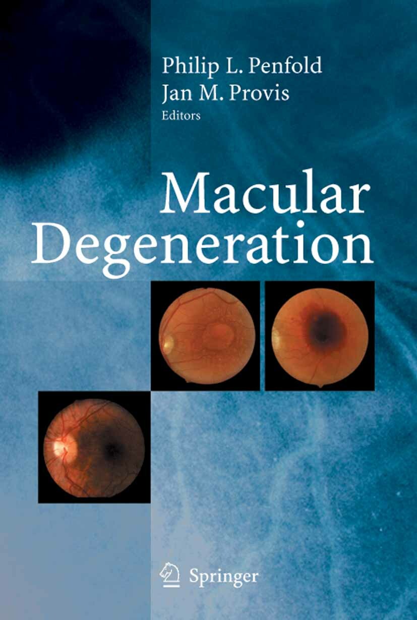 Cover Macular Degeneration