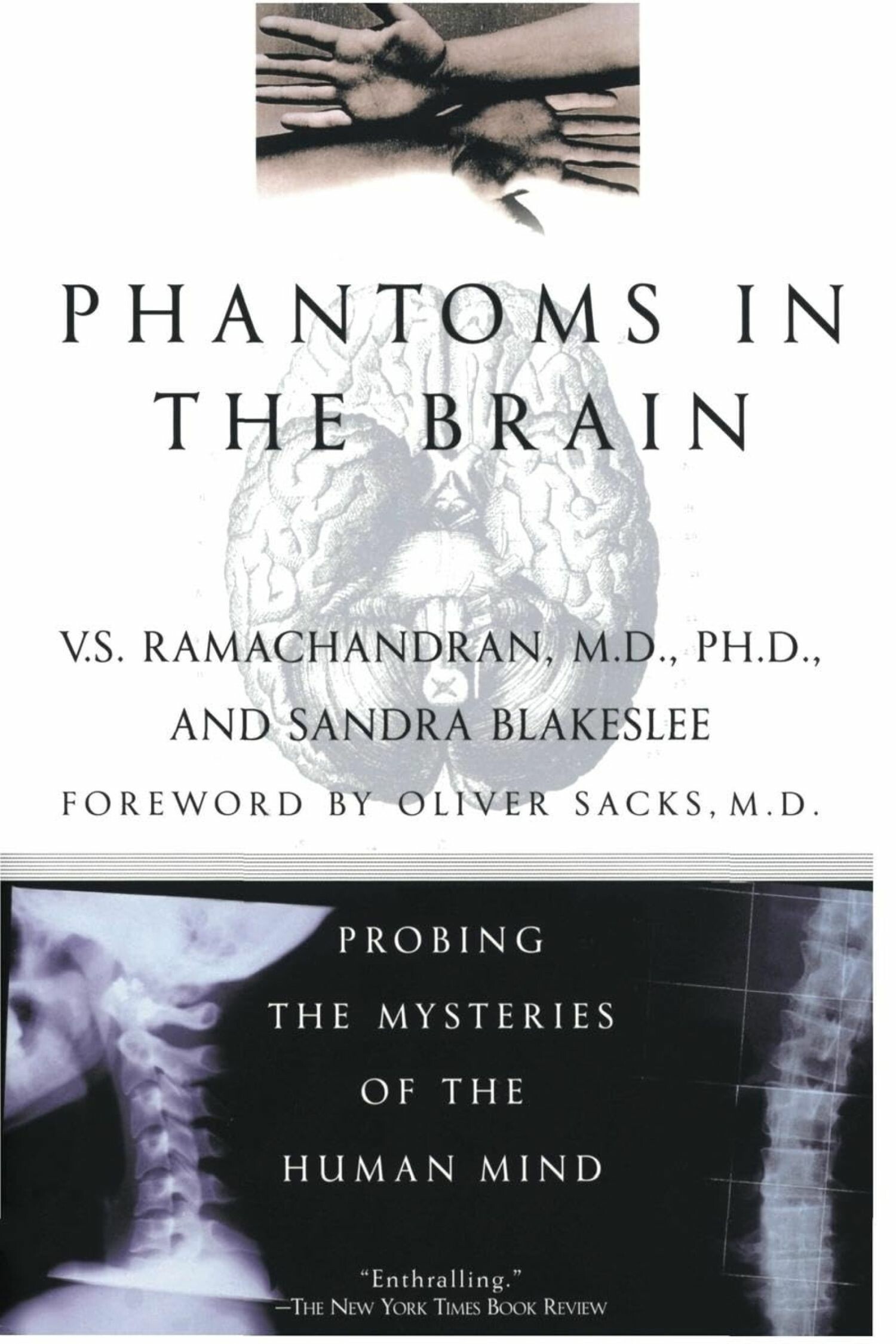 Cover Phantoms in the Brain