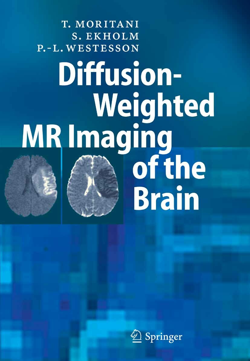 Cover Diffusion-Weighted MR Imaging of the Brain