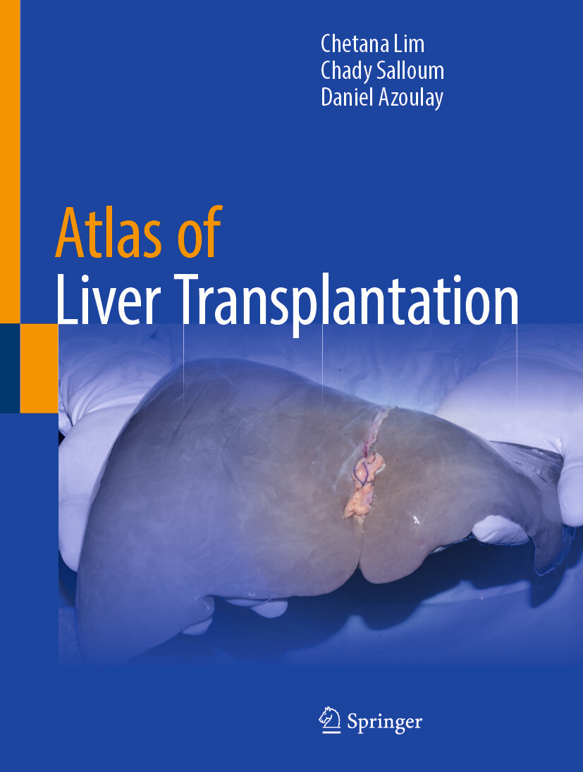 Cover Atlas of Liver Transplantation