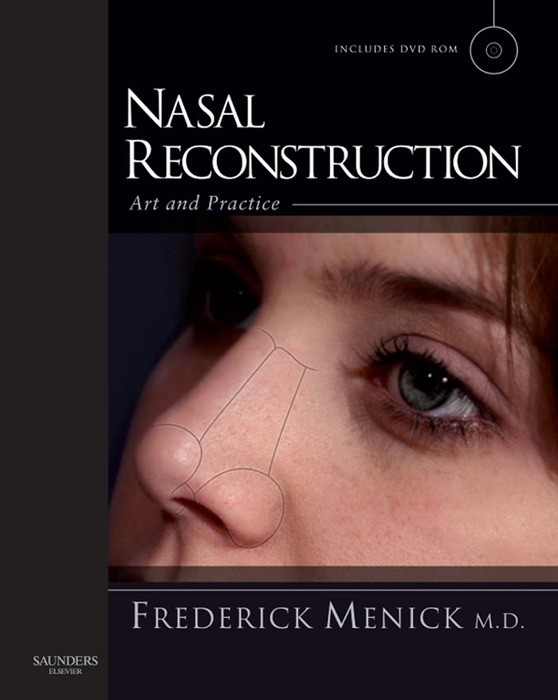 Nasal Reconstruction: Art and Practice