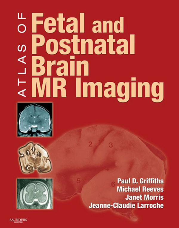 Cover Atlas of Fetal and Infant Brain MR