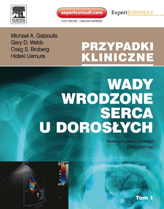 Wady wrodzone serca u doroslych. Seria Przypadki Kliniczne. Tom 1