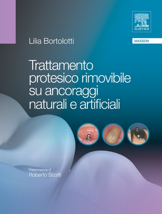 Cover Trattamento protesico rimovibile su ancoraggi naturali e artificiali