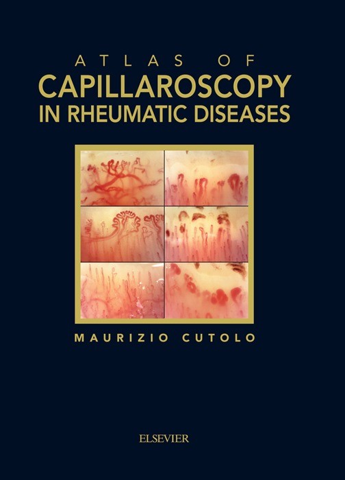 Cover Atlas of capillaroscopy in rheumatic diseases