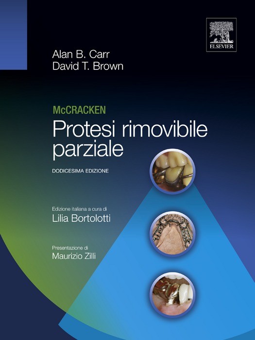 Cover Mc Cracken Protesi rimovibile parziale